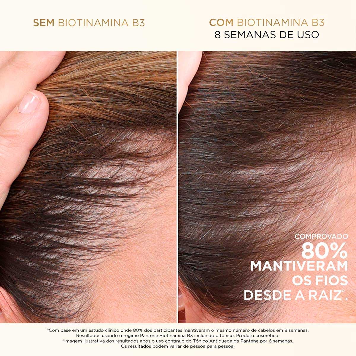 Condicionador Pantene Pro-V Miracles Biotinamina B3 Antiqueda e Nutricao 510ml