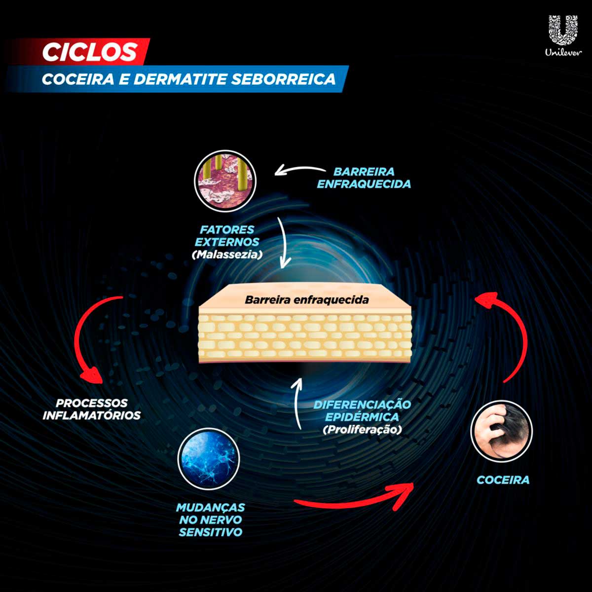 Shampoo Anticaspa Clear Sports Men Limpeza Profunda 400ml